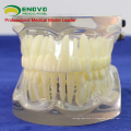 VENDRE 12572 FE dents dentaires articulaires humaines pour l&#39;étude des dents